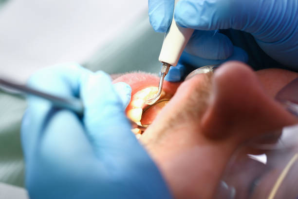 Best Emergency Treatment for Toothache in Mount Vernon, TX